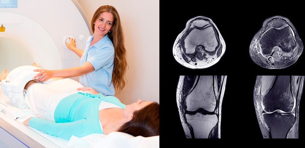 térdízület diagnózisa